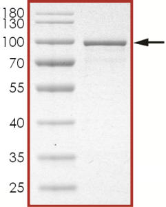 STAT1 beta Protein